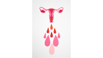 Les Culottes menstruelles pour flux abondants, très abondants ou hémorragiques, une bonne idée ?