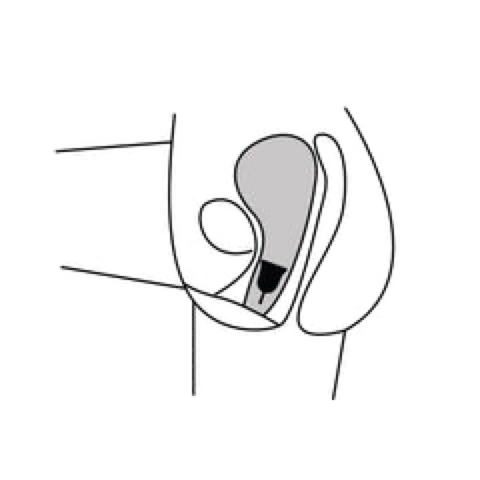 Samengesteld uit een zeer flexibel en kneedbaar materiaal, wordt de menstruatiecup veel lager gedragen dan een tampon en direct onder de baarmoederhals geplaatst. Eenmaal correct geplaatst, is er geen risico op lekken. De menstruatiecup kan op verschillende manieren worden geplaatst, afhankelijk van elke anatomie. Het kan helemaal naar binnen zitten of de stang kan iets uitsteken. Het maakt niet uit. De cup, eenmaal ingebracht, zou je absoluut niet moeten storen. Als de menstruatiecup helemaal naar binnen zit, maakt het steeltje het gemakkelijker om hem te laten zakken bij het verwijderen. Door er lichtjes aan te trekken, slagen we erin om de basis van de cup te bereiken om deze samen te knijpen en vervolgens te verwijderen. Als de menstruatiecup erg hoog zit - geen paniek - is dat volkomen normaal, duw hem gewoon naar beneden met je vaginale spieren.
