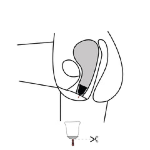 Composed of a very flexible and malleable material, the menstrual cup is worn much lower than a tampon and is placed directly under the cervix. Once properly positioned, there is no risk of leaks. The menstrual cup can be positioned in different ways depending on each anatomy. It may be completely inside or the rod may stick out slightly. It doesn't matter. The cup, once inserted, should absolutely not bother you. If the menstrual cup is completely inside, the stem makes it easier to lower it when removing. By pulling slightly on it, we manage to reach the base of the cup in order to pinch it and then remove it. If the menstrual cup sits very high - don't panic - that's completely normal, just push it down with your vaginal muscles.